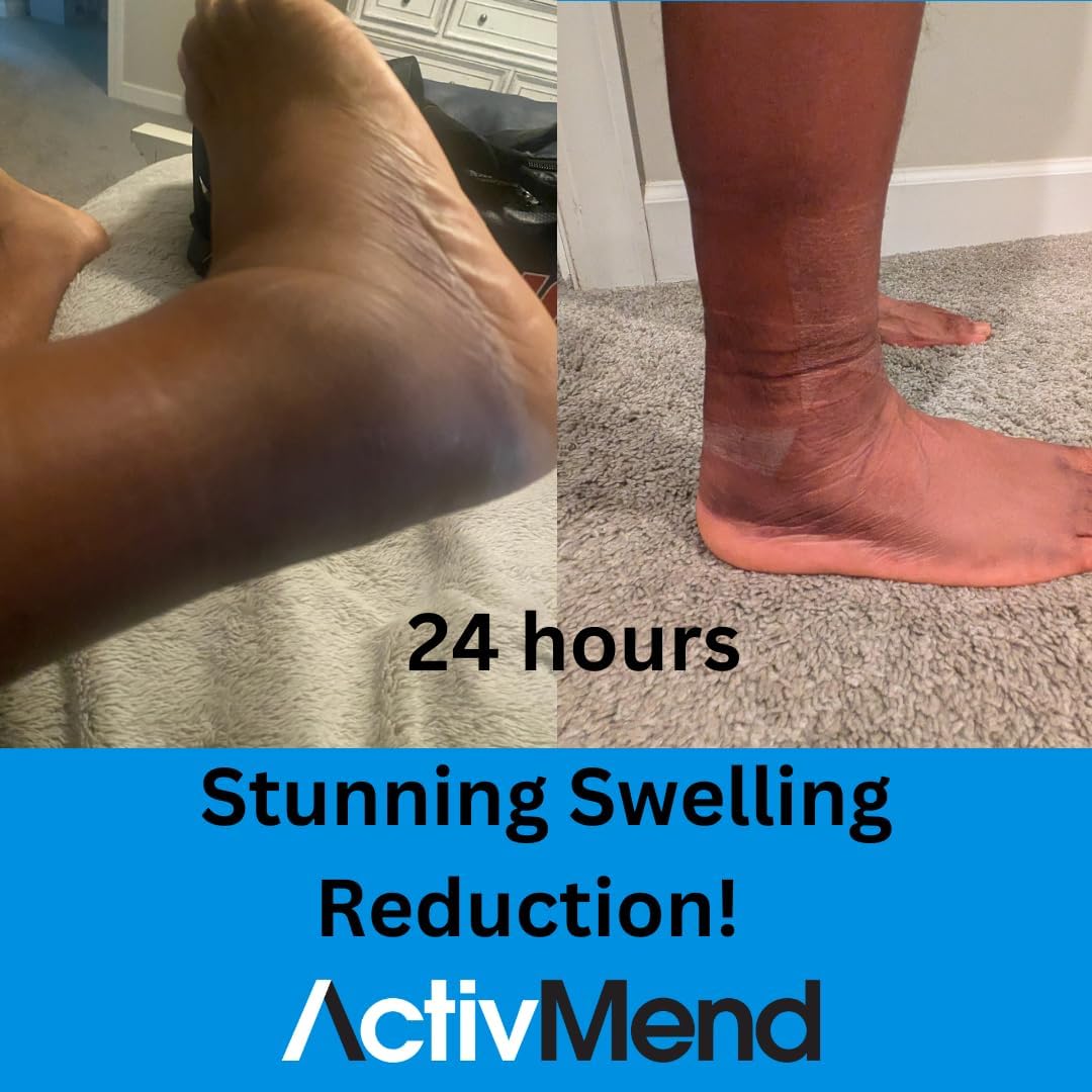 Ankle Sprain Recovery Patches – Helps Speed Up Ankle Sprain Healing & Reduce Swelling Fast | High-Potency Arnica Gel Relief Patch | 5 Patches